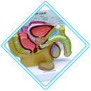 Hypospadias